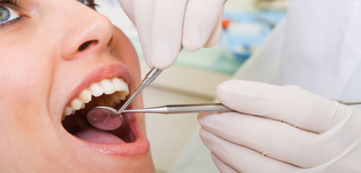 Cosmetic Dentistry Veneers